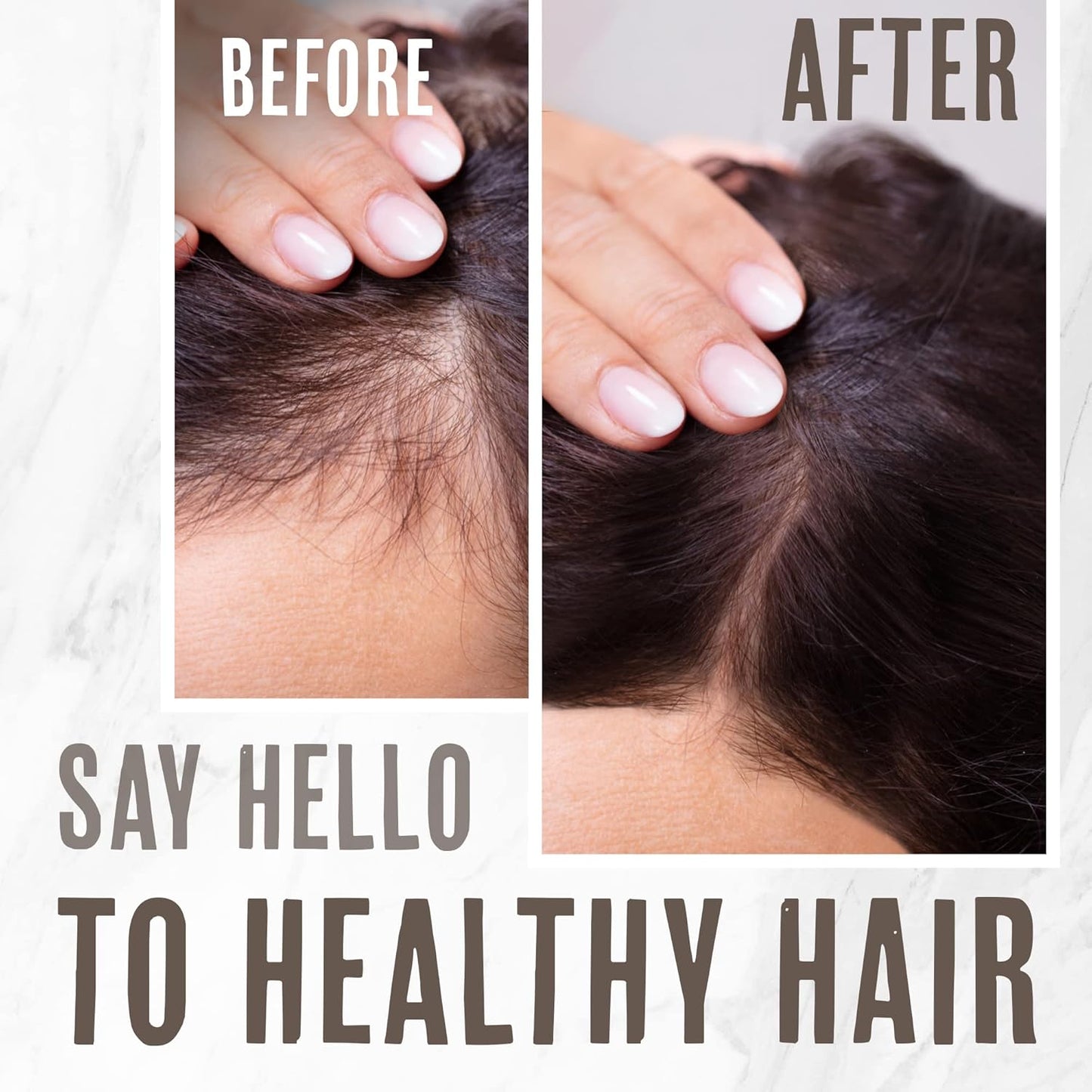 Grassfed Beauty - MSM Shampoo Bar + Hyaluronic Hair Conditioner Bar, Solid Bar Shampoo and Conditioner for Hair Growth, Non-Soap, For All Hair Types, Unscented, Set of 2